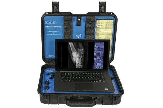 Stalo DR System